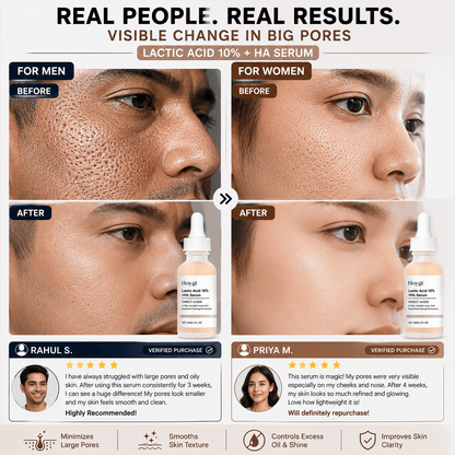 SC Pore Perfecting Serum with 10% Lactic Acid