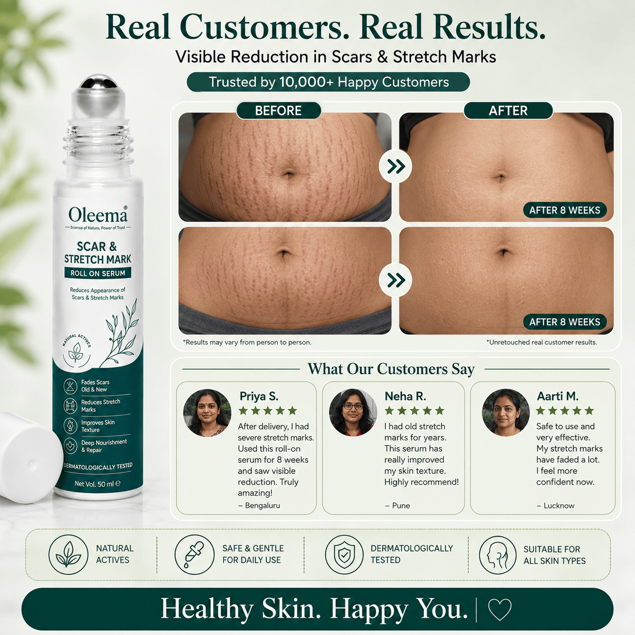SD Scar & Stretch Mark Roll-On Serum