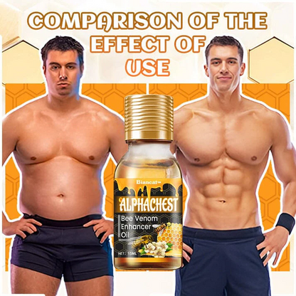 GFOUK™ MenTherm Bee Venom Gynecomastia Heating Oil-(30ml)-🔥Buy 1 Get 1 Free🔥