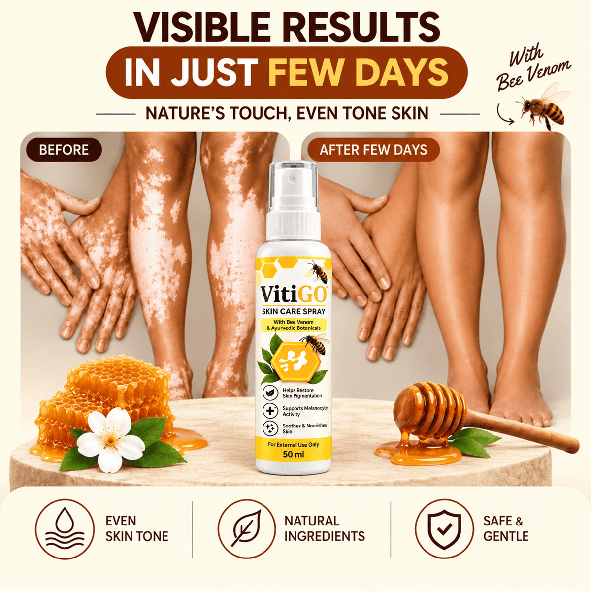MD VitiGO Skin Care Spray with Bee Venom & Ayurvedic Botanicals | Buy 1 Get 1 Free