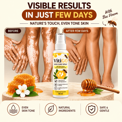MD VitiGO Skin Care Spray with Bee Venom & Ayurvedic Botanicals | Buy 1 Get 1 Free