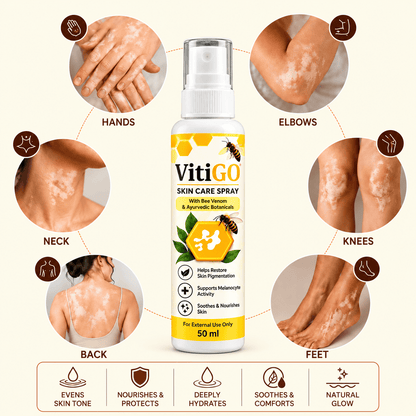 MD VitiGO Skin Care Spray with Bee Venom & Ayurvedic Botanicals | Buy 1 Get 1 Free