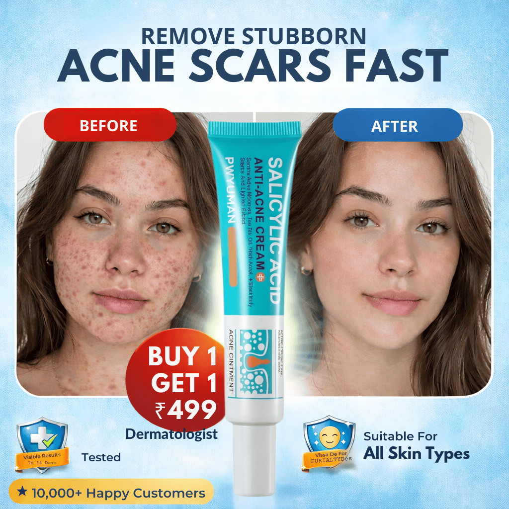 Salicylic Acid Anti-Acne Cream – Remove Stubborn Acne & Scars Fast - dmore
