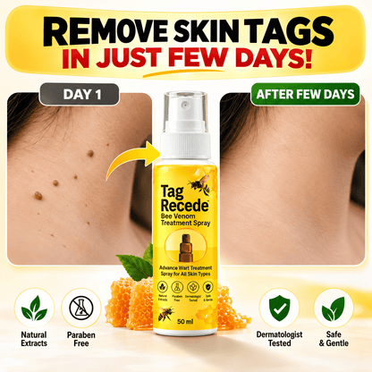 MD Advance Wart Remover Spray – Fast & Easy At-Home |Bee Venom Skin Tag Remover Spray