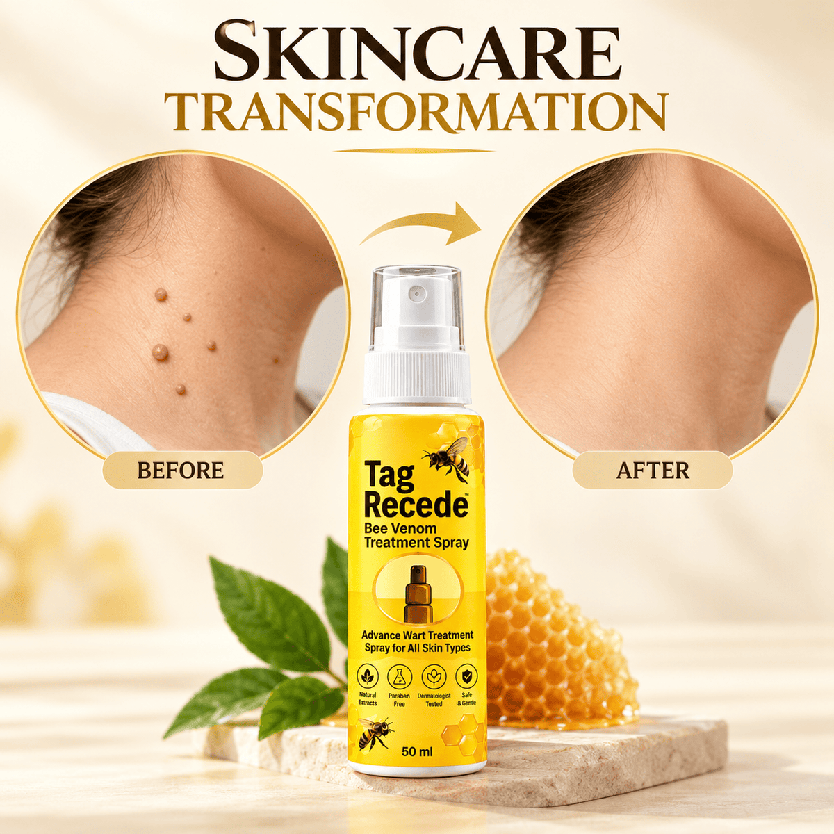 MD Advance Wart Remover Spray – Fast & Easy At-Home |Bee Venom Skin Tag Remover Spray