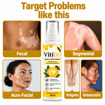 MD VitiGO Skin Care Spray with Bee Venom & Ayurvedic Botanicals | Buy 1 Get 1 Free