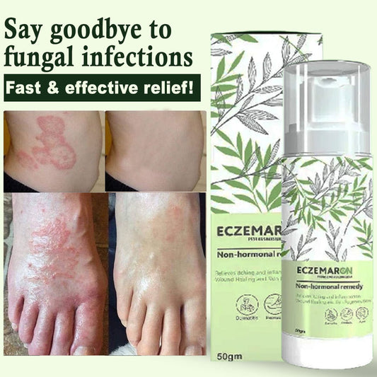 SC D-More Ecze+ Anti Fungal Spray - Doctor's Recommended 👨🏽‍⚕️ Buy 1 Get 1 Free - dmore