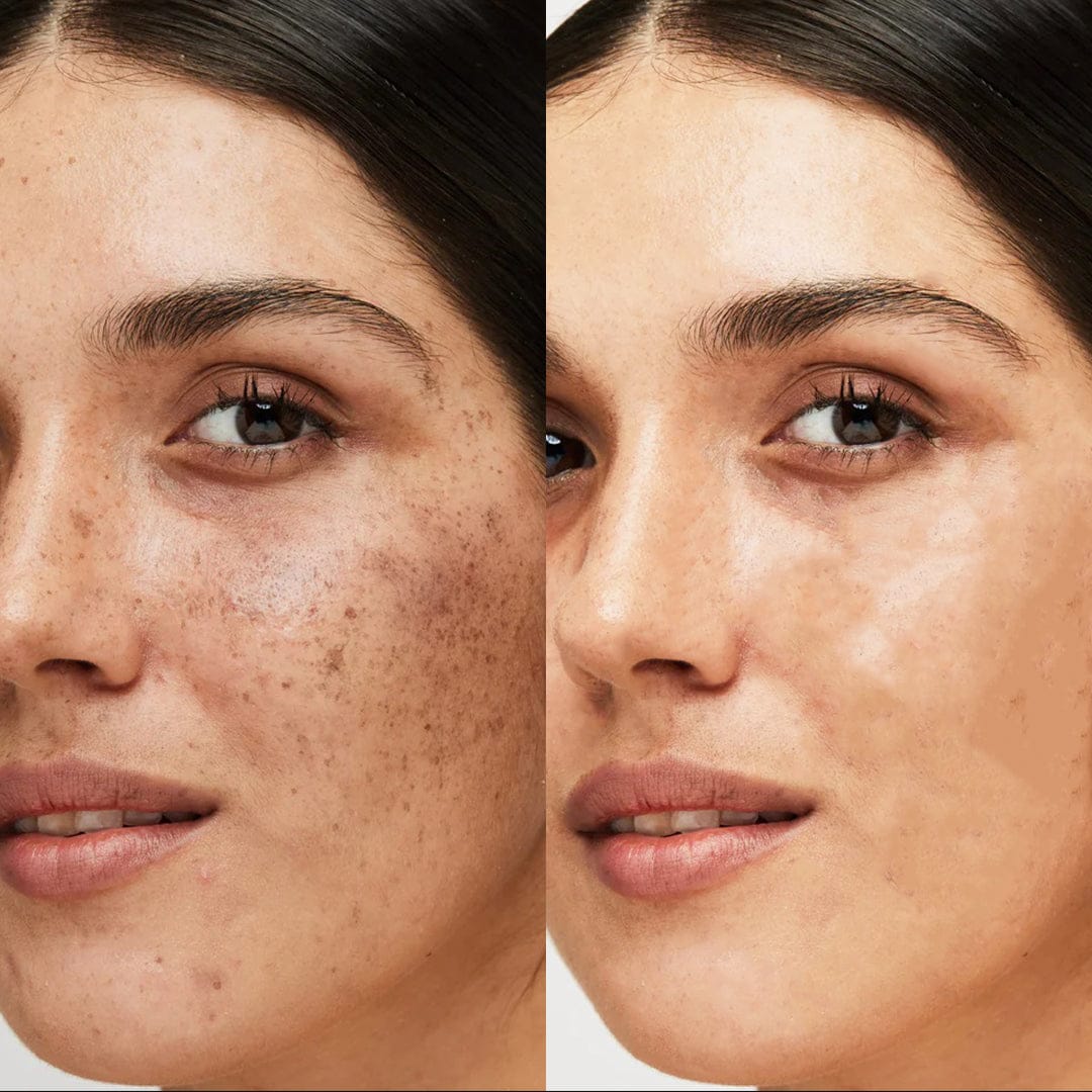 MD Korean OMI White Cream  🔥FLASH SALE LIVE🔥BUY 1 GET 1 FREE