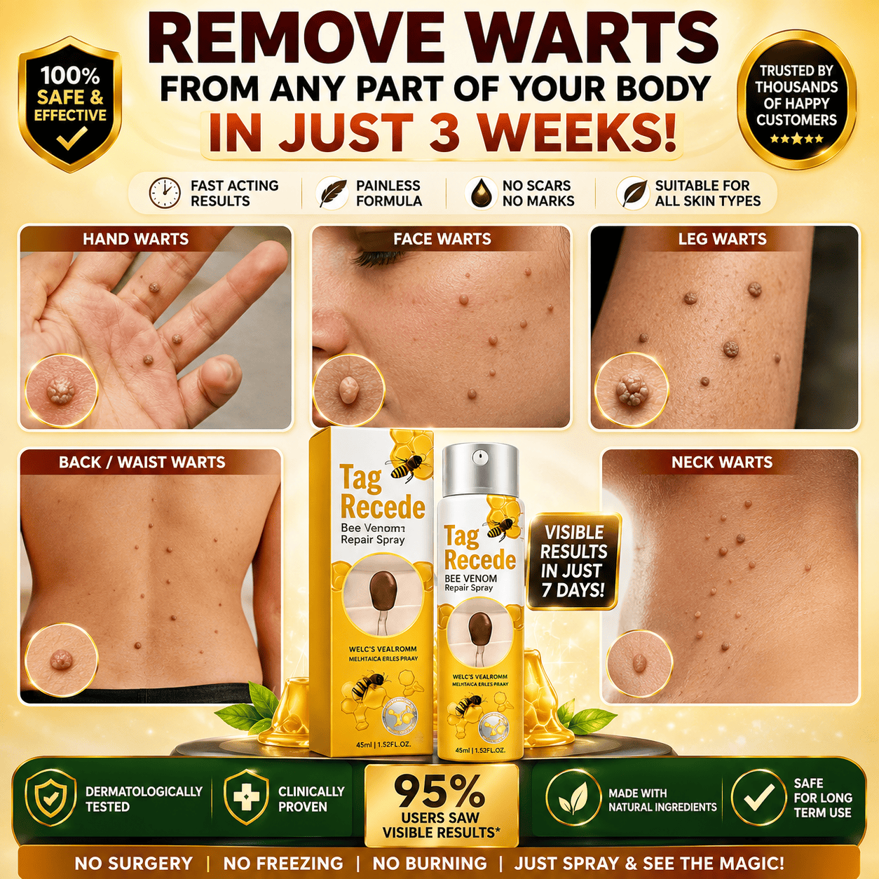 SD Bee Venom Tag & Wart Remover spray - Fast & Easy At-Home in 3 weeks