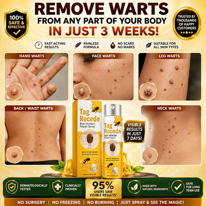 SD Bee Venom Tag & Wart Remover spray - Fast & Easy At-Home in 3 weeks
