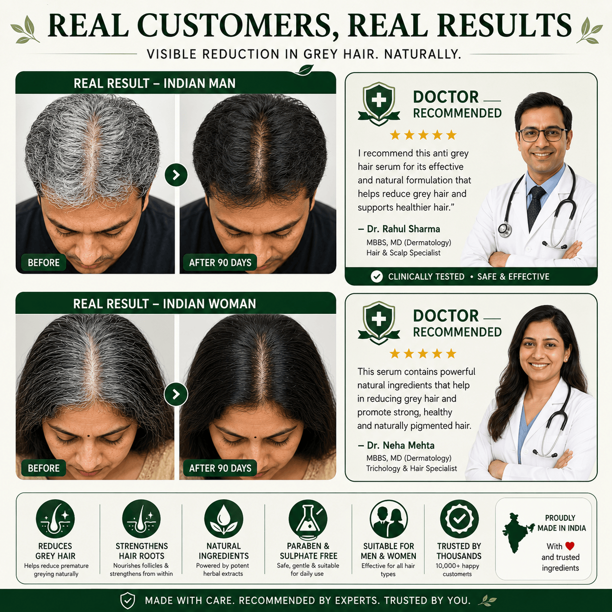 SD Oleema Anti Grey Hair Serum in just 14 days