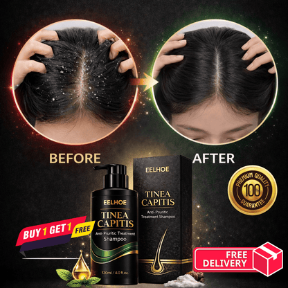 Advanced Anti-Fungal Treatment for Persistent Scalp Itching, Flakes & Root-Level Irritation. - dmore