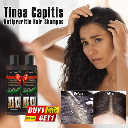 SD Powerful Anti-Dandruff Shampoo for All Hair Types – Smooth, Clean & Fresh Hair Every Wash