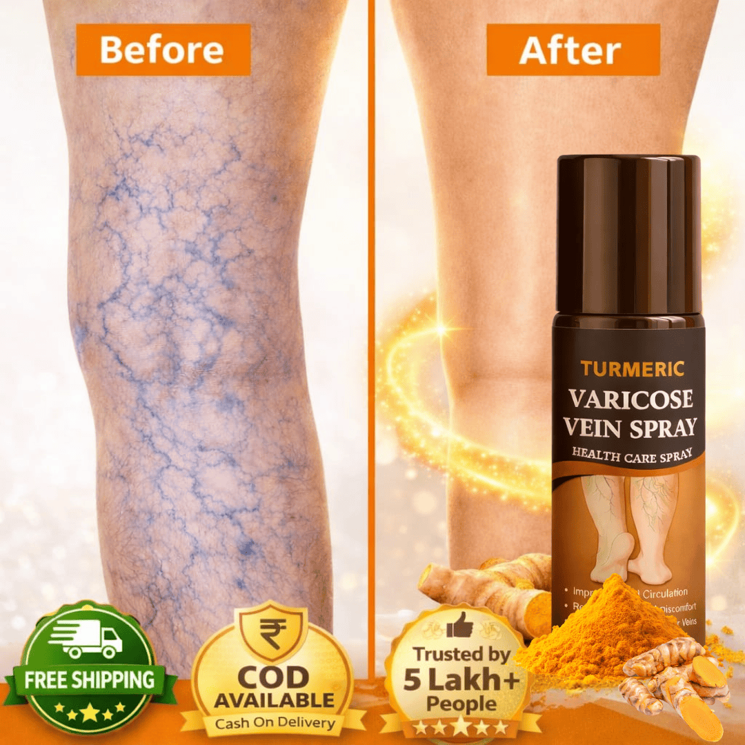 MD Herbal Turmeric Varicose Vein Spray – Feel Relief in Minutes 🌿🟡 - dmore