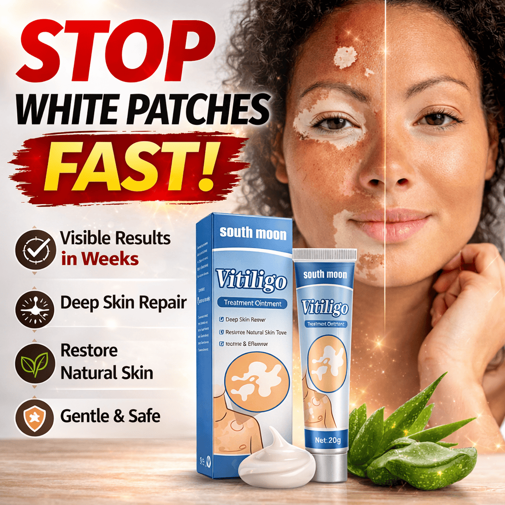 South Moon Vitiligo Treatment Ointment – Advanced Skin Repair Formula - dmore
