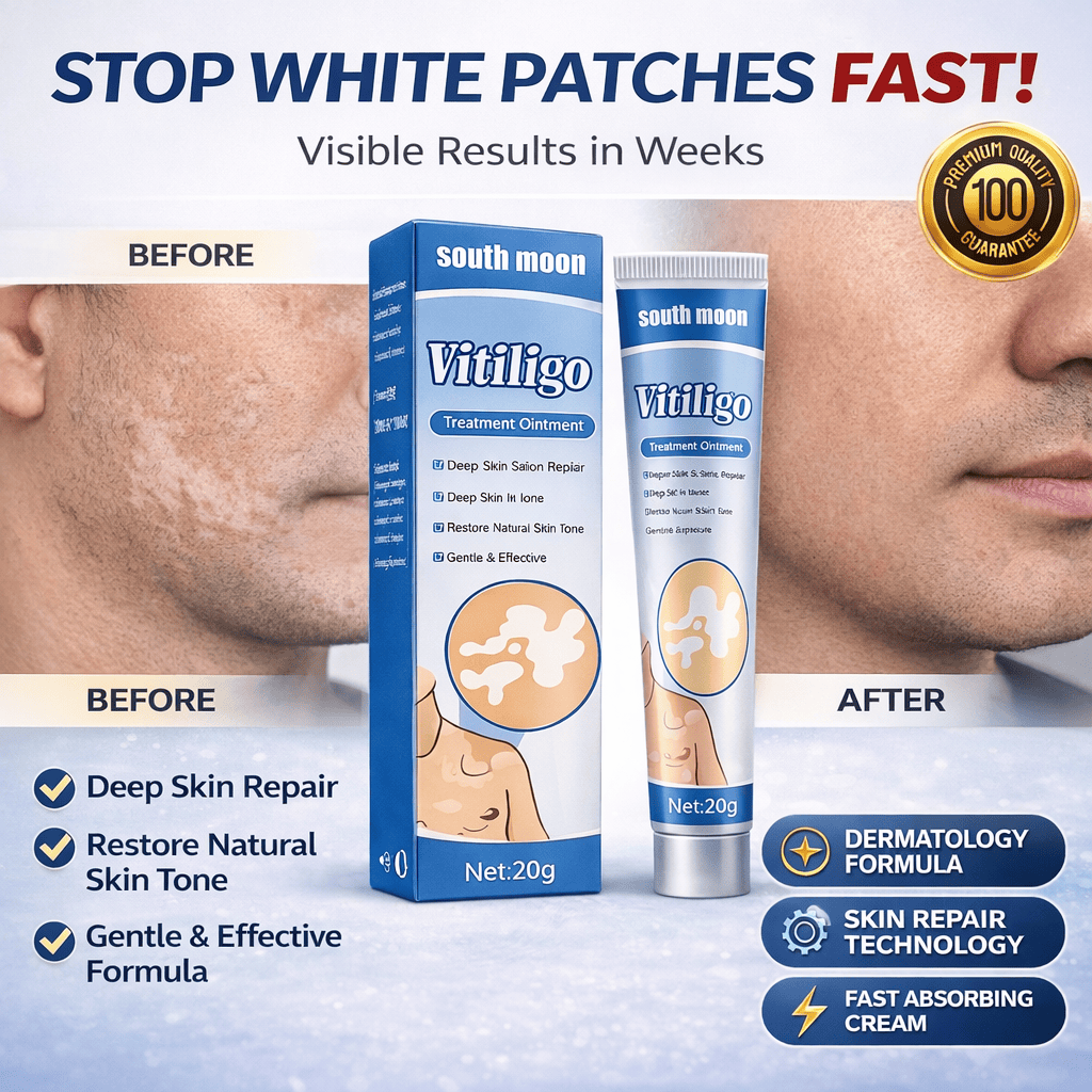 South Moon Vitiligo Treatment Ointment – Advanced Skin Repair Formula - dmore