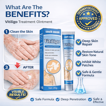 South Moon Vitiligo Treatment Ointment – Advanced Skin Repair Formula - dmore