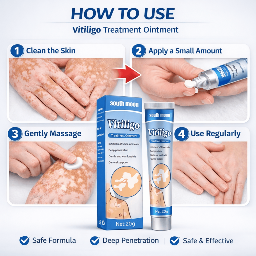 South Moon Vitiligo Treatment Ointment – Advanced Skin Repair Formula - dmore