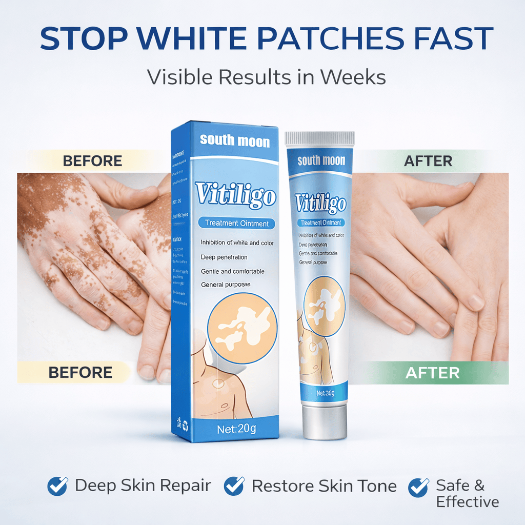 South Moon Vitiligo Treatment Ointment – Advanced Skin Repair Formula - dmore