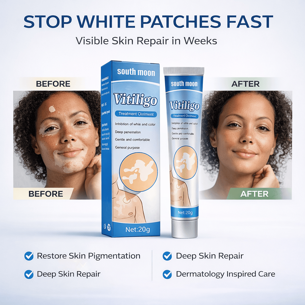 South Moon Vitiligo Treatment Ointment – Advanced Skin Repair Formula - dmore