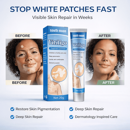 South Moon Vitiligo Treatment Ointment – Advanced Skin Repair Formula - dmore