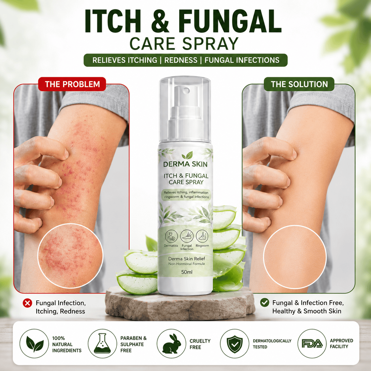 Derma Skin Itch & Fungal Care Spray- Dermatologist Inspired Itch & Fungal Care👨🏽‍⚕️