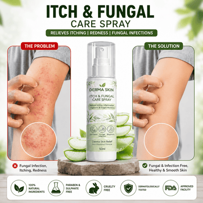 Derma Skin Itch & Fungal Care Spray- Dermatologist Inspired Itch & Fungal Care👨🏽‍⚕️