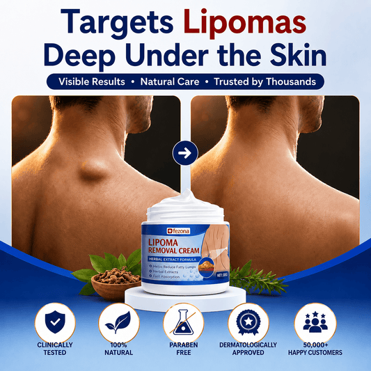 MD Herbal Lipoma Cream | Expert-Recommended Herbal Skin Formula ⭐