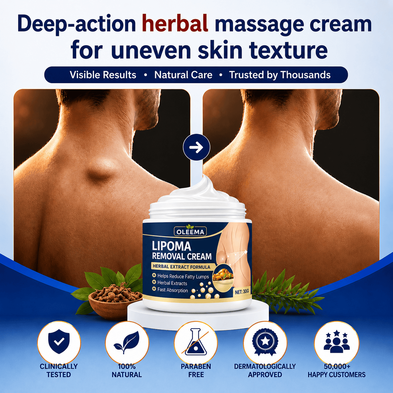 MD Herbal Skin Care Cream for Uneven Skin Texture | Expert-Recommended Formula