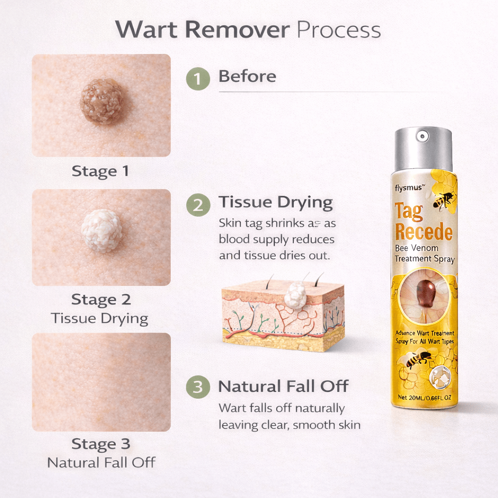 SD Bee Venom Tag & Wart Remover spray - Fast & Easy At-Home in 3 weeks - dmore