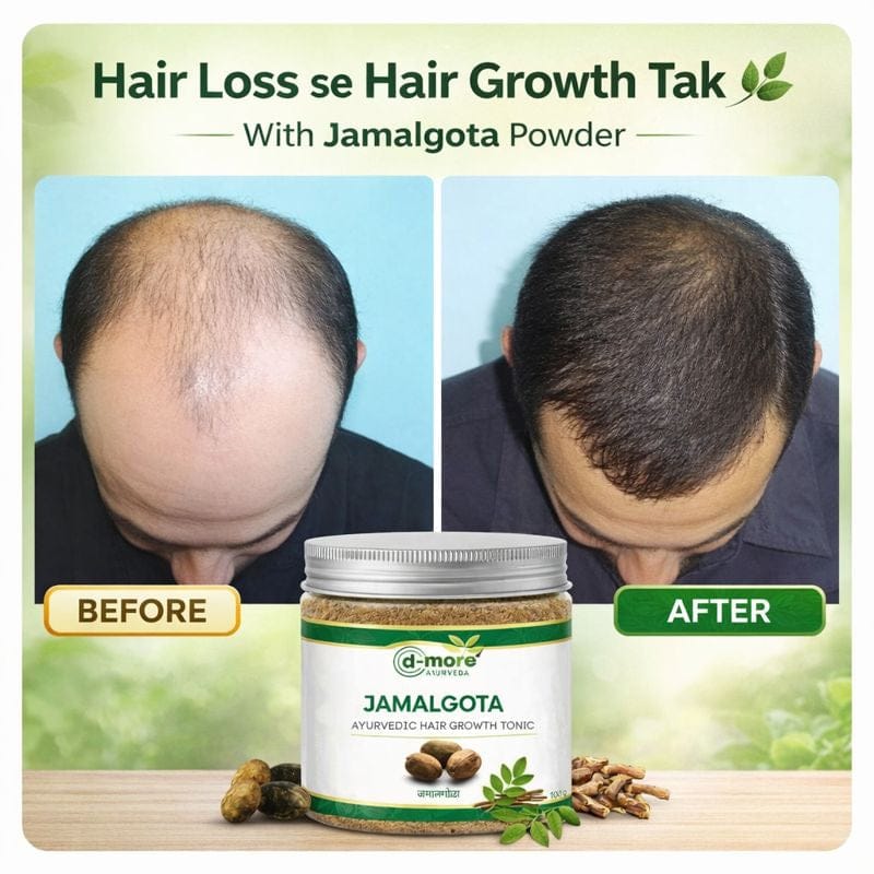 MD Jamalgota Ayurvedic Hair Growth & Care Powder 🌿 - dmore