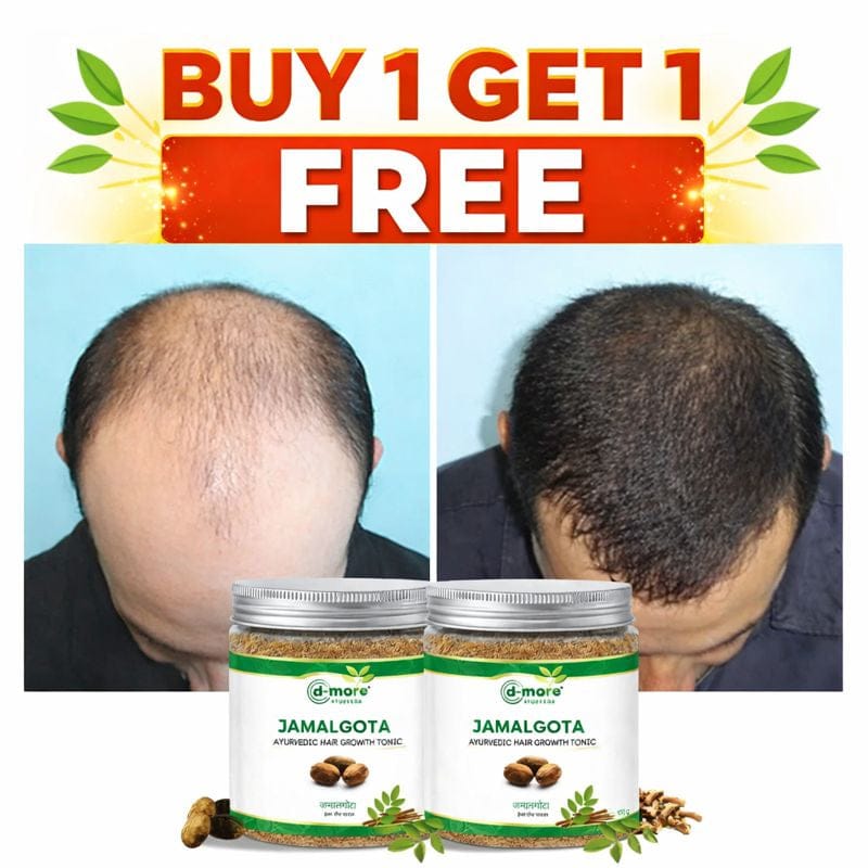 MD Jamalgota Ayurvedic Hair Growth & Care Powder 🌿 - dmore