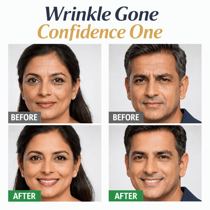 🔥MD Buy 1 Get 1 Free 🔥 Lutein Firming & Anti-Wrinkle Serum - dmore