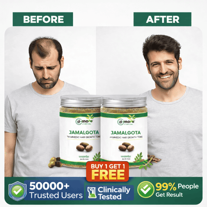 MD Jamalgota Ayurvedic Hair Growth & Care Powder 🌿 - dmore