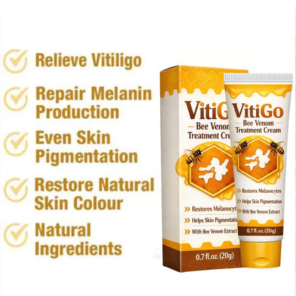 Vitigo™ Advanced Vitiligo Restore Cream ✨ | Buy 1 Get 1 Free 🔥 - dmore