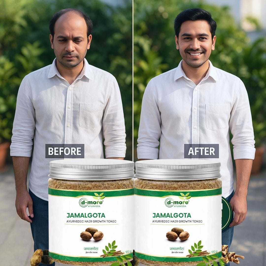 MD Jamalgota Ayurvedic Hair Growth & Care Powder 🌿 - dmore