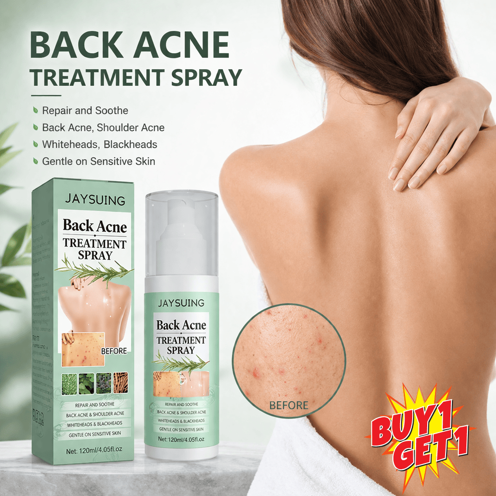 SD Back Acne Spray – Easy, Effective, Acne-Free 🌿 - dmore