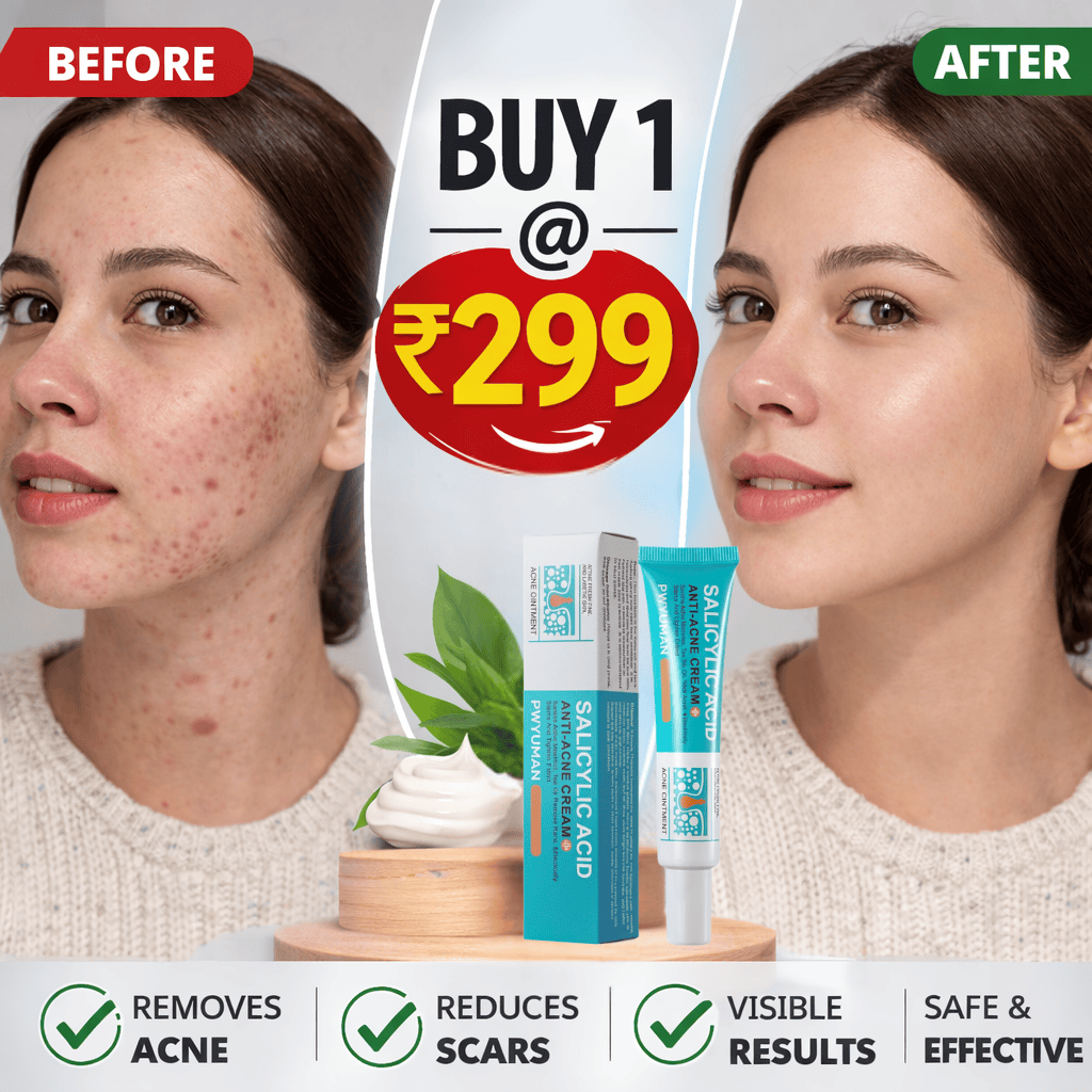 Salicylic Acid Anti-Acne Cream – Remove Stubborn Acne & Scars Fast - dmore