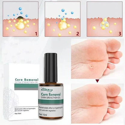 SD Corn Removal Serum 👣 No More Pain, No More Corns - ✨ Buy 1 Get 1 Free ⚡ - dmore