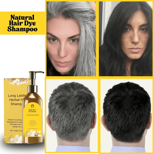 SD Japanese Herbal Hair Dye Shampoo – Instantly Covers Grays in 5 Minutes! 🔥 Buy 1 Get 1 Free 🔥