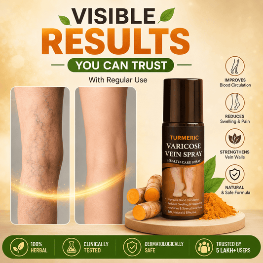 MD Herbal Turmeric Varicose Vein Spray – 💚 Herbal Support for Varicose Vein Discomfort