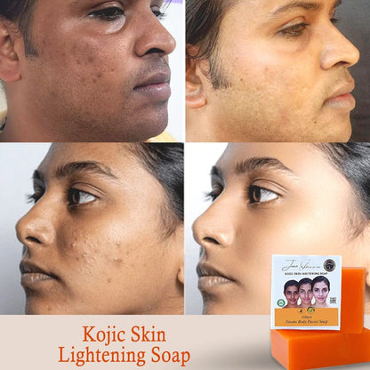MD🧼✨ GlowRevive™ Kojic Acid Soap – Detan & Brighten Naturally!🔥 Buy 1 Get 1 Free🔥 - dmore
