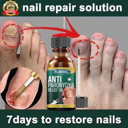 💅SD Anti-Paronychia Nail Relief Oil  🔥 Buy 1 Get 1 FREE @ Just ₹399! 🔥