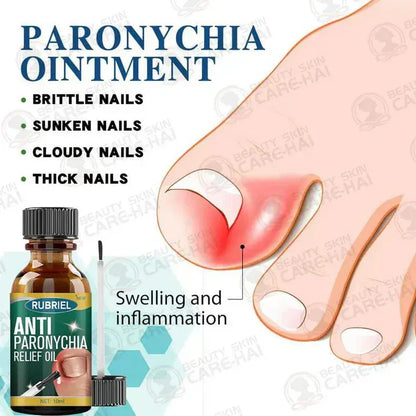 💅SD Anti-Paronychia Nail Relief Oil  🔥 Buy 1 Get 1 FREE @ Just ₹399! 🔥