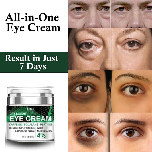 SD All-in-One Eye Cream - Say Goodbye to Puffiness & Wrinkles! 💖 Buy 1 Get 1 Free💖 - dmore