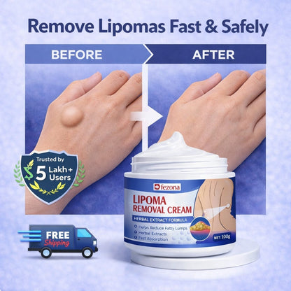 MD Herbal Lipoma Removal Cream 🔥 Doctors 1st Choice 👩‍⚕️ - dmore