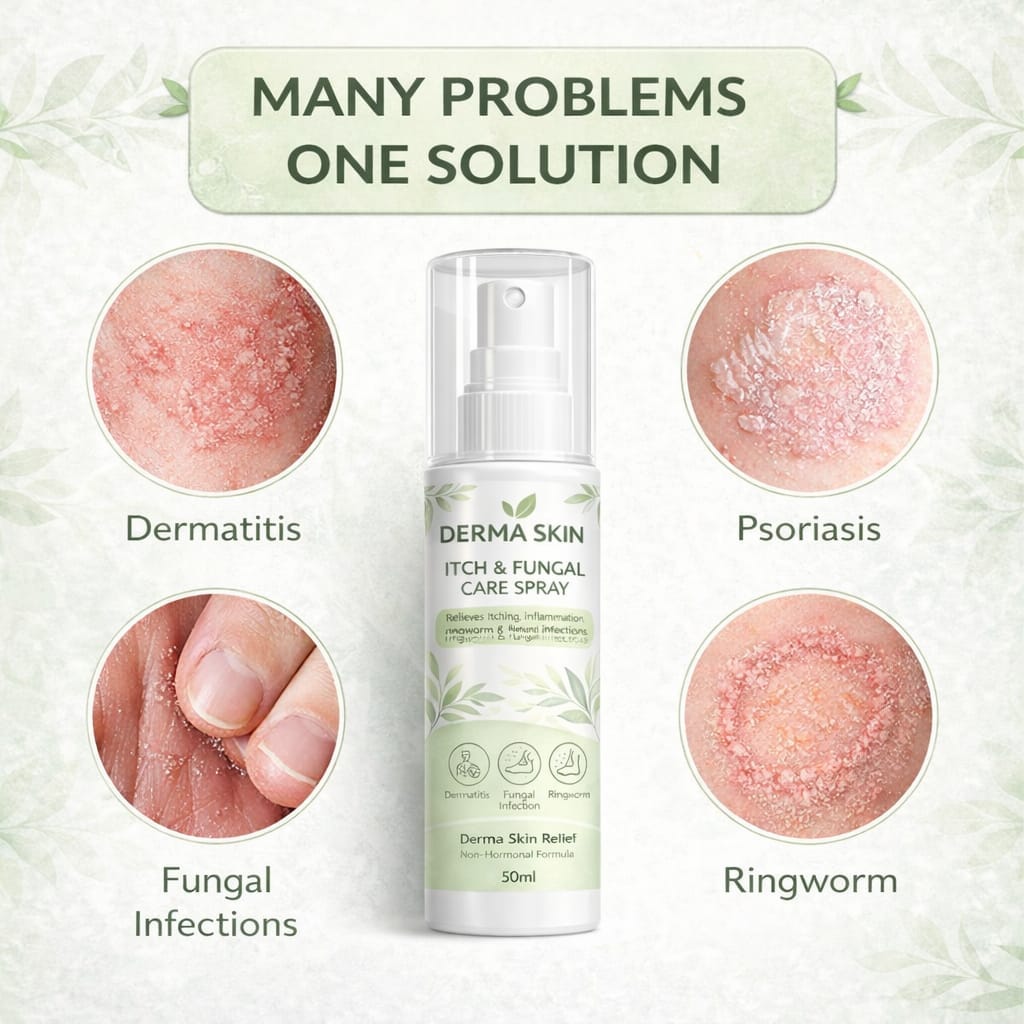 Derma Skin Itch & Fungal Care Spray- Dermatologist Inspired Itch & Fungal Care👨🏽‍⚕️ - dmore