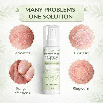 Derma Skin Itch & Fungal Care Spray- Dermatologist Inspired Itch & Fungal Care👨🏽‍⚕️ - dmore