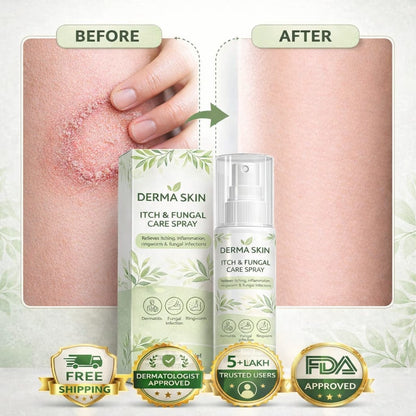 Derma Skin Itch & Fungal Care Spray- Dermatologist Inspired Itch & Fungal Care👨🏽‍⚕️ - dmore