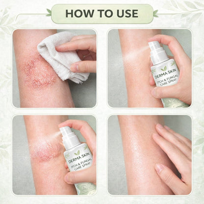 Derma Skin Itch & Fungal Care Spray- Dermatologist Inspired Itch & Fungal Care👨🏽‍⚕️ - dmore